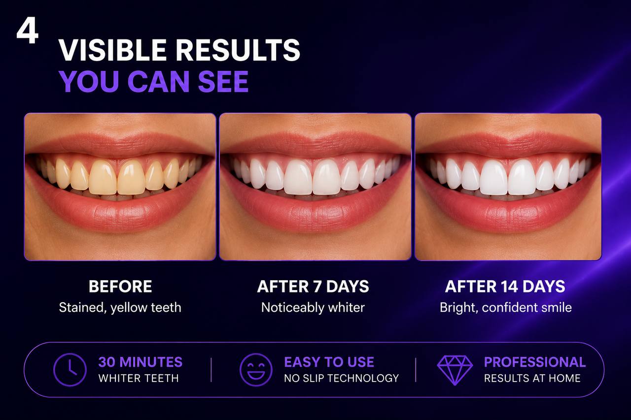 GlowDentCare Professional Teeth Whitening Strips